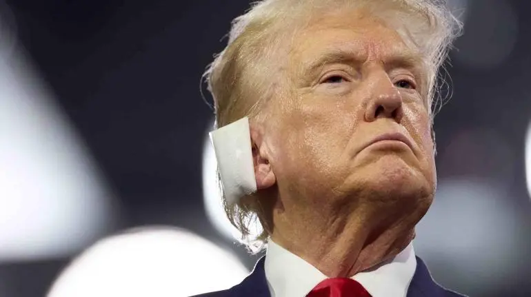 La bala estuvo a 6 milímetros de entrar en su cabeza, asegura médico de Trump La bala estuvo a 6 milímetros de entrar en su cabeza, asegura médico de Trump