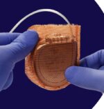 Lanzan en México tecnología que previene a pacientes con diabetes de infecciones asociadas a dispositivos implantables